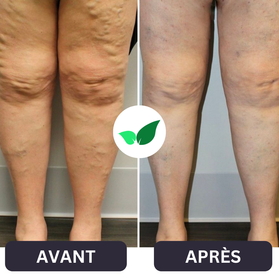 NOVA™ Masseur Anti-Douleur Pour Pieds