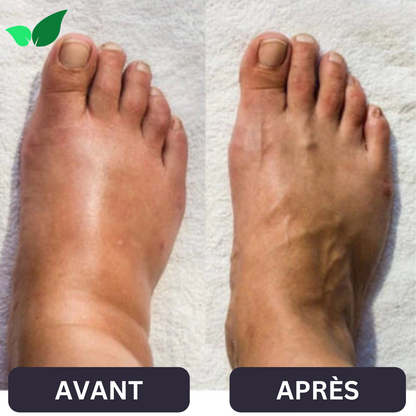 NOVA™ Masseur Anti-Douleur Pour Pieds